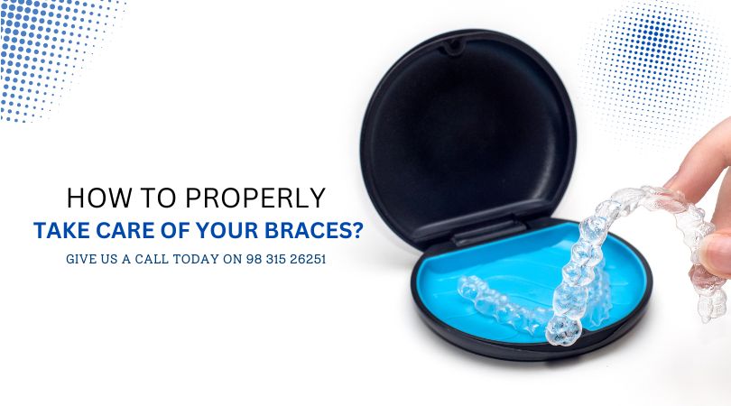 How to Properly Take Care of Your Braces?