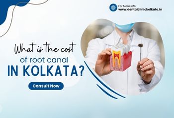 What is the cost of a root canal in Kolkata?