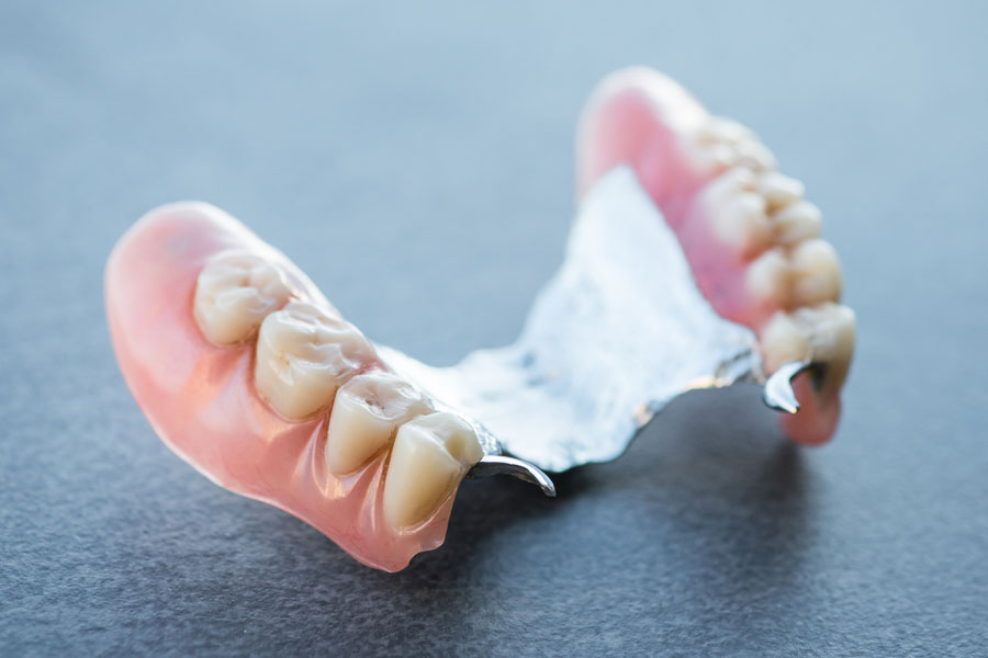 Fixed partial denture or dental bridge is a fixed option to replace missing teeth