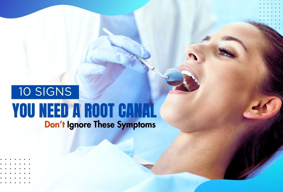 10 Signs You Need a Root Canal: Don’t Ignore These Symptoms