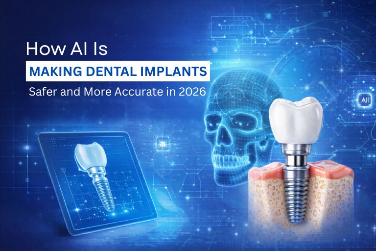 How AI Is Making Dental Implants Safer in 2026