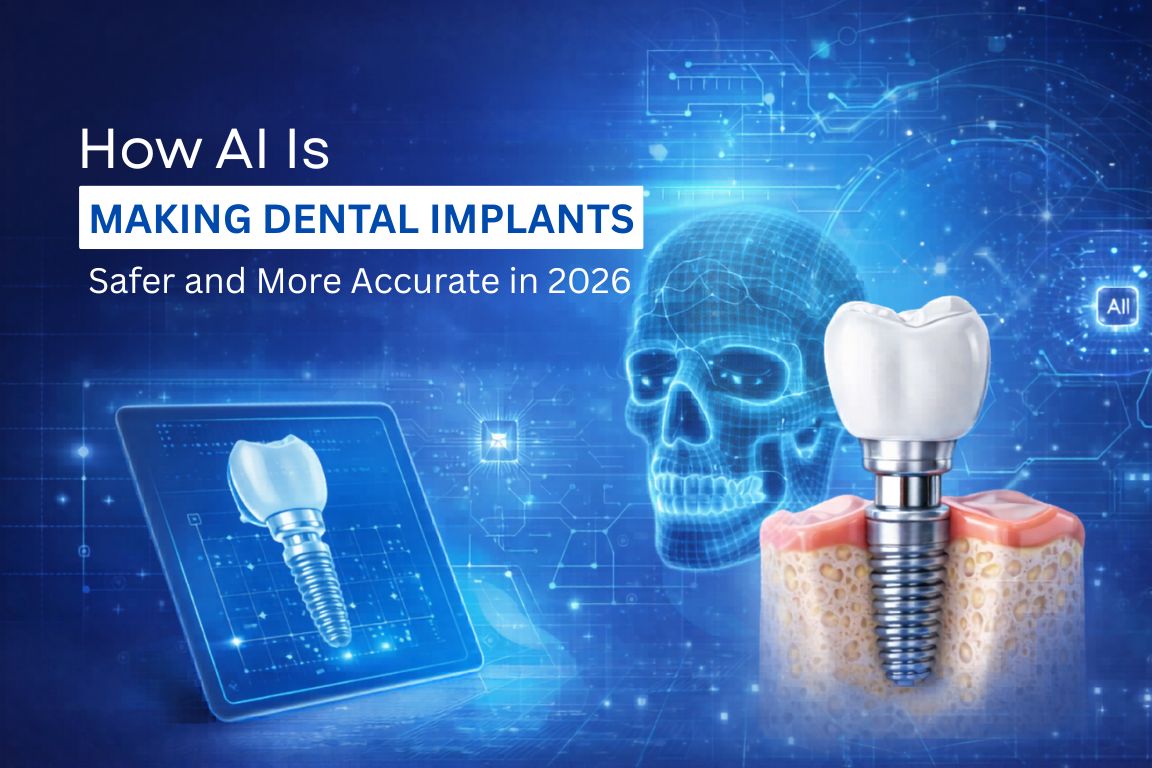 How AI Is Making Dental Implants Safer in 2026