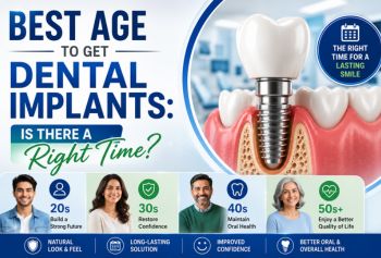 Best Age to Get Dental Implants: Is There a Right Time?