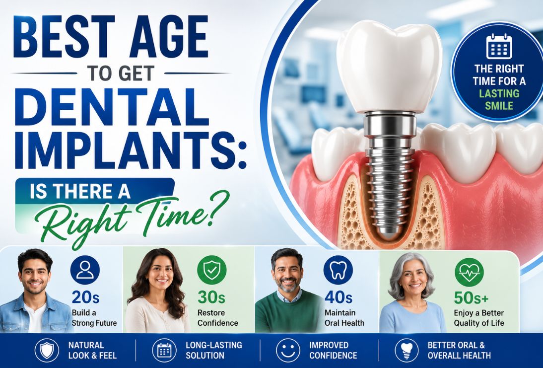 Best Age to Get Dental Implants: Is There a Right Time?