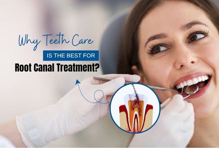 Painless Root Canal Treatment at Teeth Care Kolkata