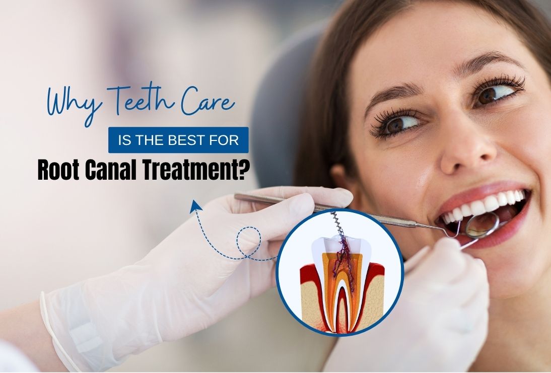 Painless Root Canal Treatment at Teeth Care Kolkata
