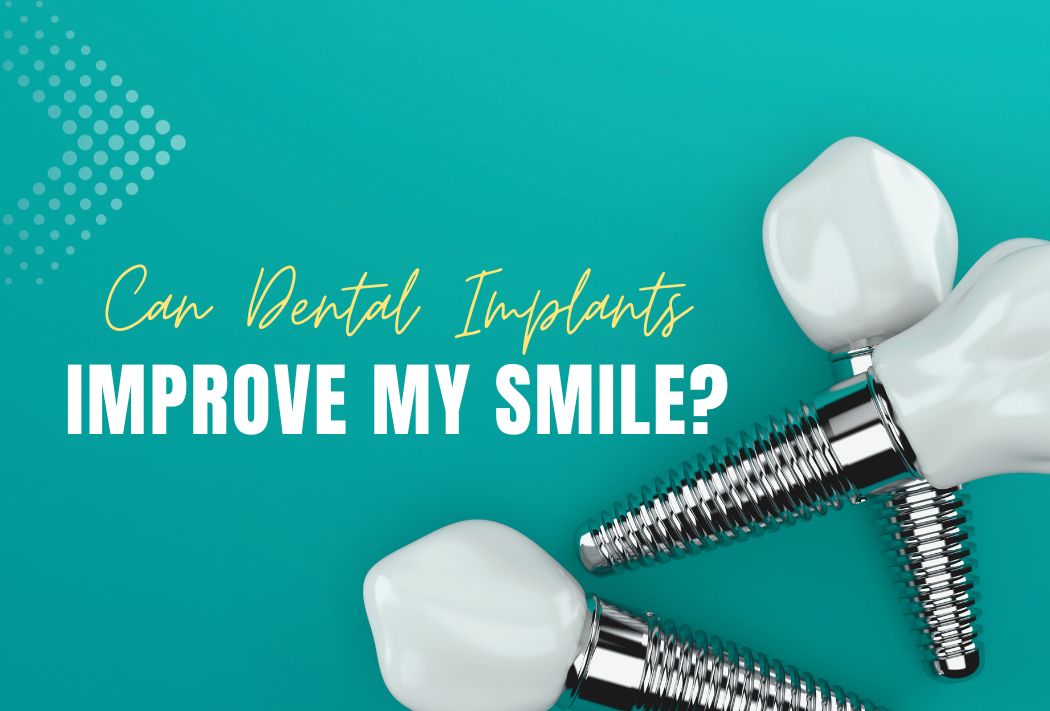 Can Dental Implants Improve My Smile?