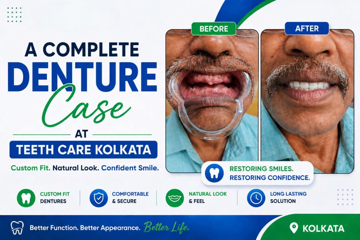 A Complete Denture Case at Teeth Care Kolkata