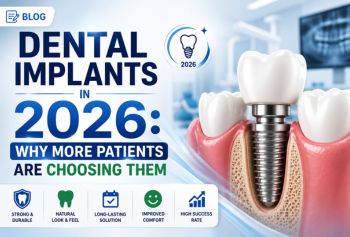 Dental Implants in 2026: Why More Patients Are Choosing Them