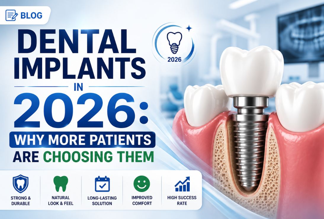 Dental Implants in 2026: Why More Patients Are Choosing Them