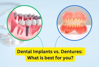 Dental Implants vs. Dentures: What is Best for You?