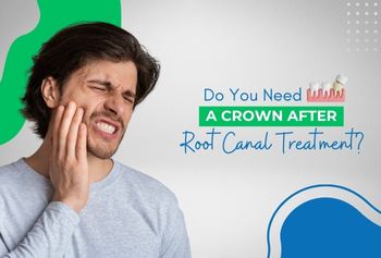 Do You Need a Crown After Root Canal Treatment?