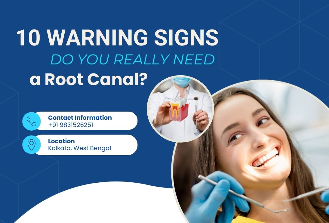 Do You Really Need a Root Canal? 10 Warning Signs