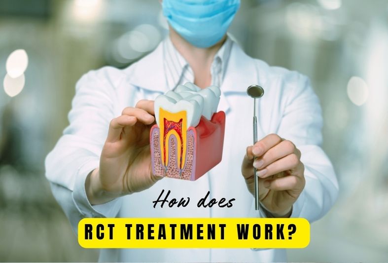How does RCT treatment work?