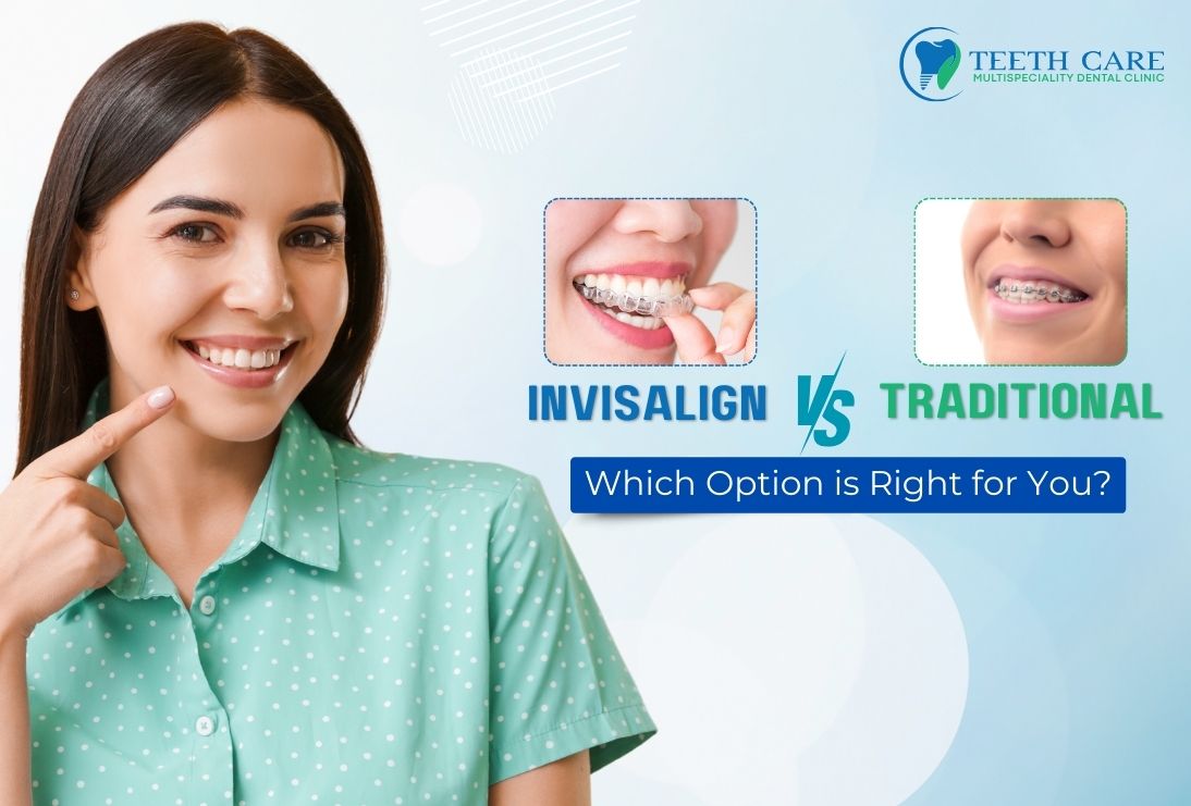 Invisalign vs. Traditional Braces: Which Option is Right for You?