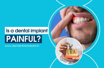 Is a dental implant painful?