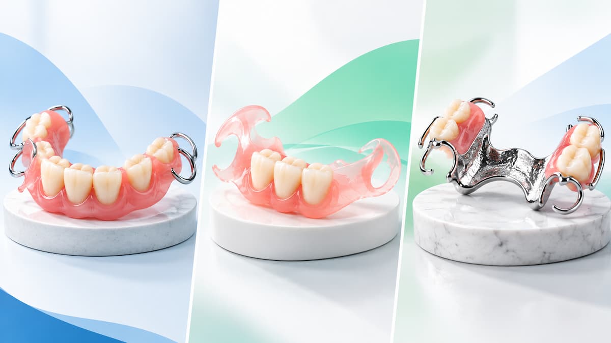 Acrylic, flexible and cast partial dentures compared side by side