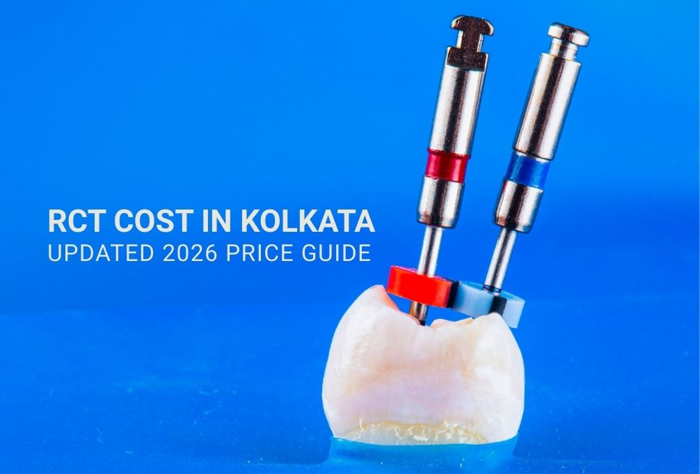 RCT Cost in Kolkata 2026 | Root Canal Treatment Price Guide