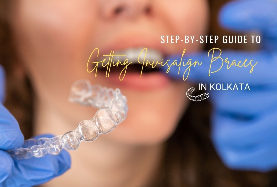 Step-by-Step Guide to Getting Invisalign Braces in Kolkata