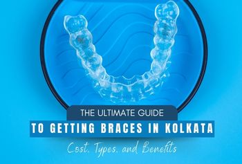 The Ultimate Guide to Getting Braces in Kolkata: Cost, Types, and Benefits