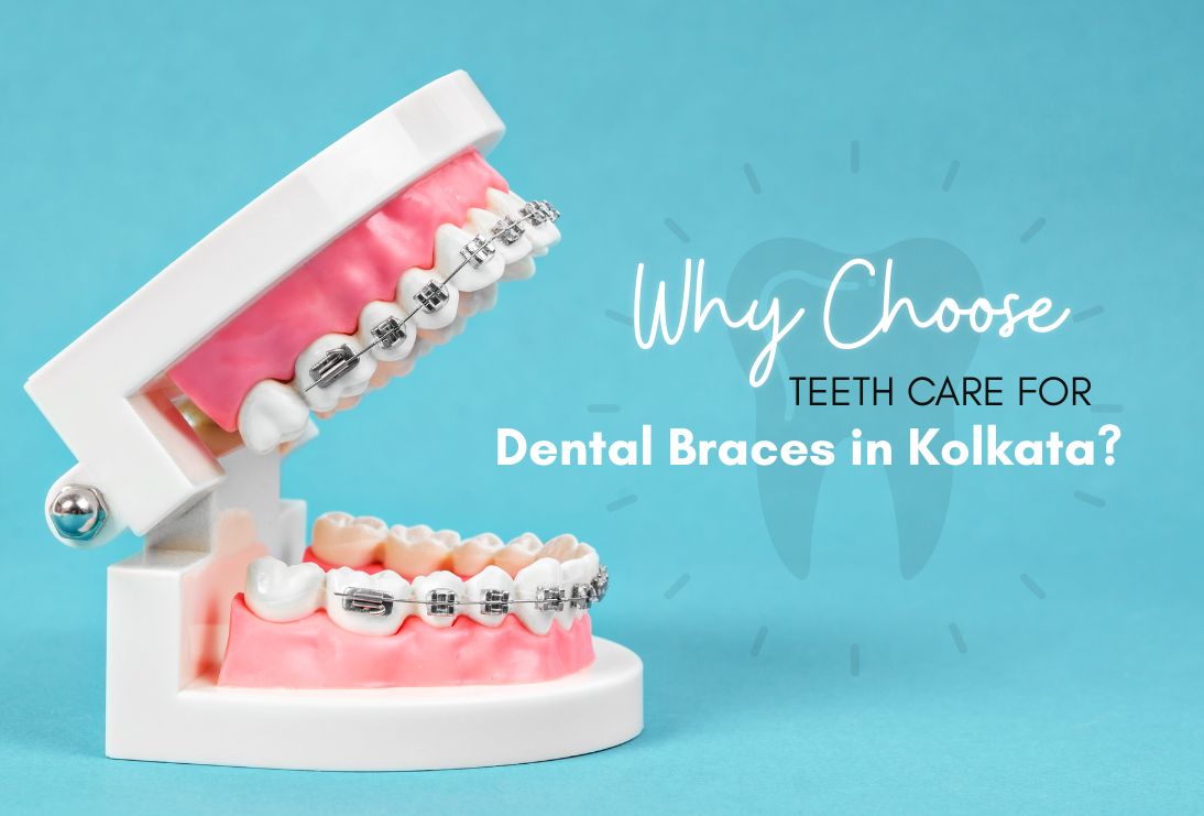 Why Teeth Care is the Best for Dental Braces in Kolkata?