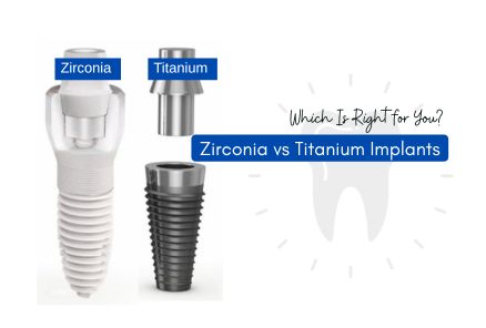 Why Choose Teeth Care for Invisible Dental Braces in Kolkata?