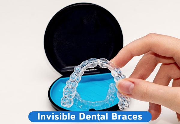 Tropical Dental Clinic - Braces (bracelets), are dental metallic decides  use to correct (re-align) crooked (mis-aligned) teeth back in one line as  shown below. To get this treatment, WhatsApp number 0784 531919