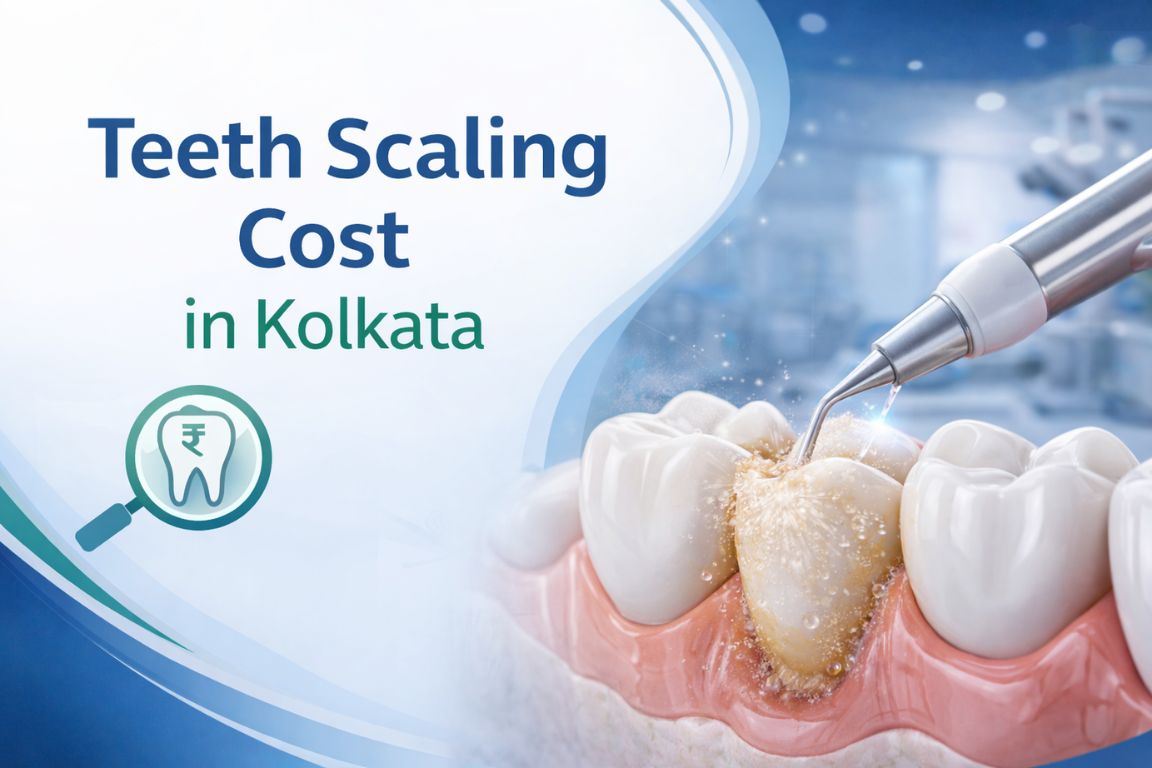 Illustration showing Teeth Scaling in Kolkata procedure with plaque and tartar removal from teeth for improved oral hygiene.